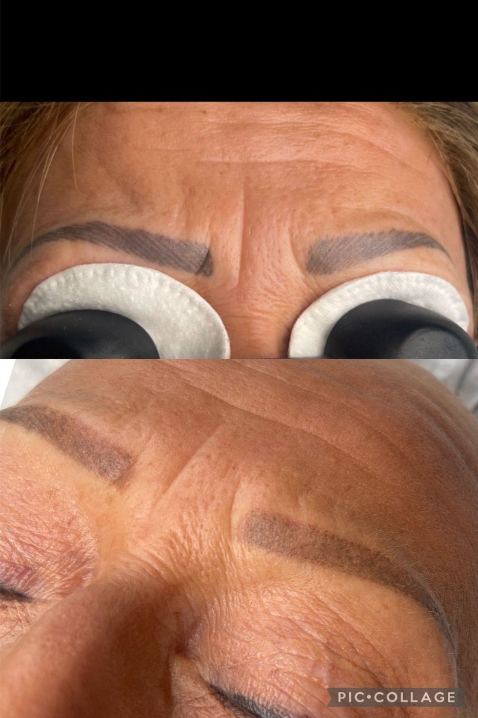 A before and after picture of a woman 's forehead.
