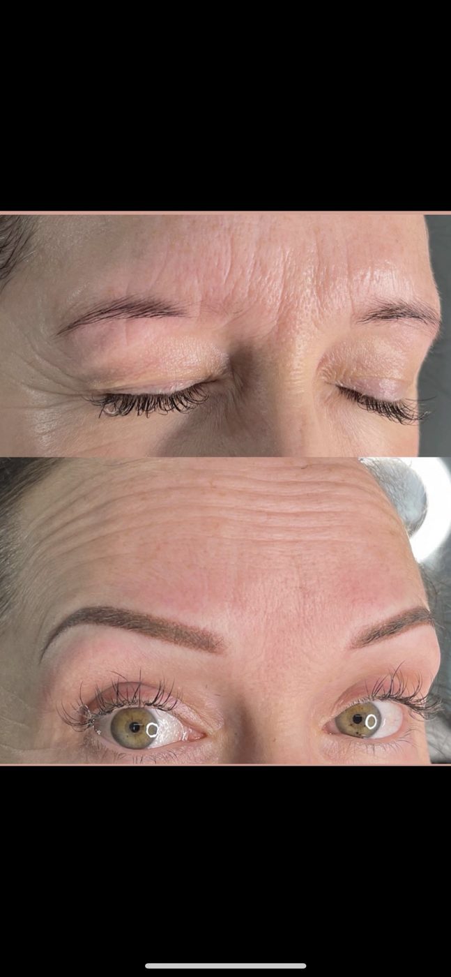 A before and after picture of a woman 's eyebrows.
