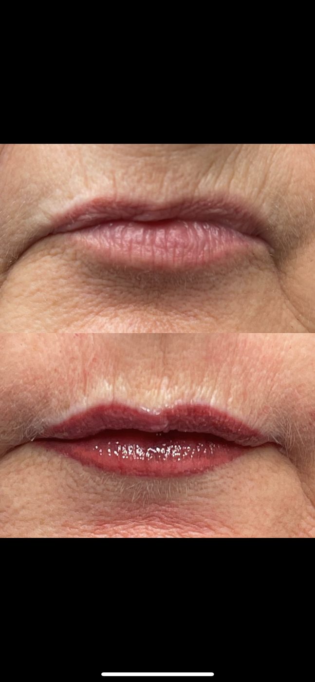A before and after picture of a woman 's lips.
