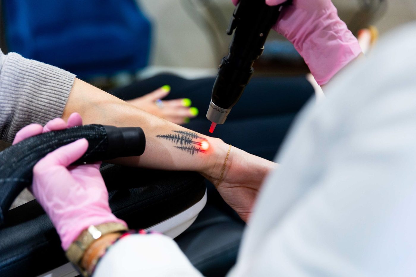 A woman is getting a tattoo removed from her arm.